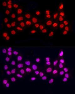 Immunofluorescence analysis of A-431 cells using Anti-hnRNP A2B1 Antibody (A307245) at a dilution of 1:50 (40X lens). DAPI was used to stain the cell nuclei (blue)