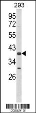 Anti-ADORA1 Rabbit Polyclonal Antibody