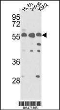 Anti-PICK1 Rabbit Polyclonal Antibody (APC (Allophycocyanin))