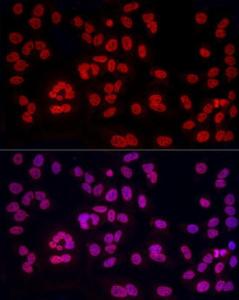 Immunofluorescence analysis of HeLa cells using Anti-hnRNP A2B1 Antibody (A307245) at a dilution of 1:50 (40X lens). DAPI was used to stain the cell nuclei (blue)