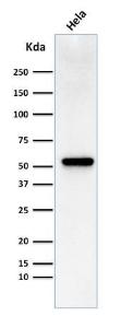 Anti-Fascin Mouse Monoclonal Antibody [clone: FSCN1/418]