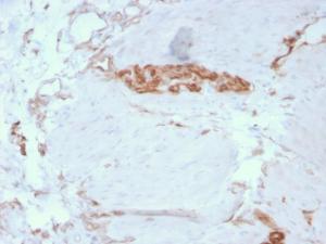 Immunohistochemical analysis of formalin-fixed, paraffin-embedded human colon using Anti-alpha Fodrin Antibody [SPTAN1/3351]