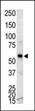 Anti-CAMK1G (CaMKI gamma) Rabbit Polyclonal Antibody