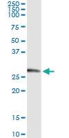 Anti-KLK2 Mouse Monoclonal Antibody [clone: 3C5]