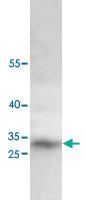 Anti-CNN1 Rabbit Polyclonal Antibody