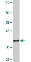 Anti-VNN3 Mouse Monoclonal Antibody [clone: 3E1]