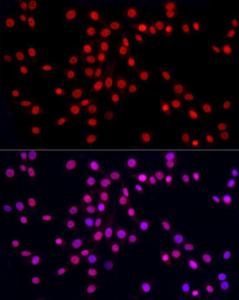 Immunofluorescence analysis of NIH/3T3 cells using Anti-hnRNP A2B1 Antibody (A307245) at a dilution of 1:50 (40X lens). DAPI was used to stain the cell nuclei (blue)