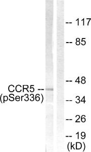 Western blot analysis of lysates from Jurkat cells using Anti-CCR5 (phospho Ser336) Antibody. The right hand lane represents a negative control, where the antibody is blocked by the immunising peptide.