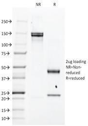 SDS-PAGE analysis of Anti-EGFR Antibody [H9B4] under non-reduced and reduced conditions; showing intact IgG and intact heavy and light chains, respectively. SDS-PAGE analysis confirms the integrity and purity of the antibody