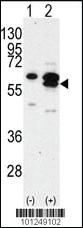 Anti-CAMK1G (CaMKI gamma) Rabbit Polyclonal Antibody