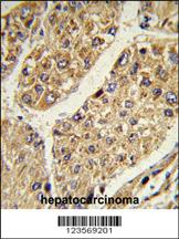 Anti-ADORA1 Rabbit Polyclonal Antibody