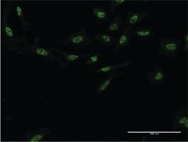 Anti-AIPL1 Mouse Monoclonal Antibody [clone: 1E1]