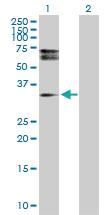 Anti-HDGFRP3 Rabbit Polyclonal Antibody