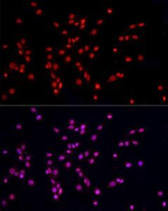 Immunofluorescence analysis of PC-12 cells using Anti-hnRNP A2B1 Antibody (A307245) at a dilution of 1:50 (40X lens). DAPI was used to stain the cell nuclei (blue)