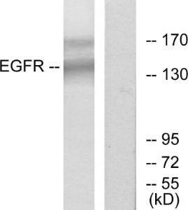 Western blot analysis of lysates from HT-29 cells using Anti-EGFR Antibody The right hand lane represents a negative control, where the antibody is blocked by the immunising peptide