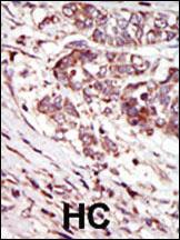 Anti-CAMK1G (CaMKI gamma) Rabbit Polyclonal Antibody