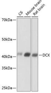 Anti-Doublecortin Rabbit Monoclonal Antibody [clone: ARC0380]