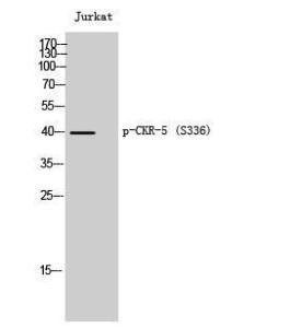 Western blot analysis of Jurkat cells using Anti-CCR5 (phospho Ser336) Antibody