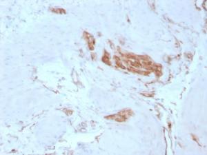 Immunohistochemical analysis of formalin-fixed, paraffin-embedded human tonsil using Anti-alpha Fodrin Antibody [SPTAN1/3351]