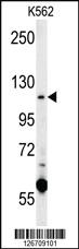 Anti-CACNA2D4 Rabbit Polyclonal Antibody