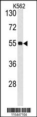 Anti-CAMK1G Rabbit Polyclonal Antibody