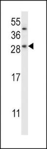 Anti-CHMP2B Rabbit Polyclonal Antibody (AP (Alkaline Phosphatase))