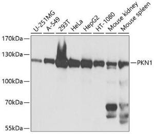 Western blot analysis of extracts of various cell lines, using Anti-PKN1 Antibody (A12648) at 1:1,000 dilution. The secondary antibody was Goat Anti-Rabbit IgG H&L Antibody (HRP) at 1:10,000 dilution.