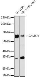 Western blot analysis of extracts of various cell lines, using Anti-CAMKIV Antibody [ARC1506] (A305710) at 1:1,000 dilution The secondary antibody was Goat Anti-Rabbit IgG H&L Antibody (HRP) at 1:10,000 dilution Lysates/proteins were present at 25 µg per lane