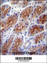 Anti-SAMD9 Rabbit Polyclonal Antibody