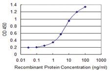 Anti-AIPL1 Mouse Monoclonal Antibody [clone: 1E1]