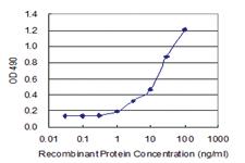 Anti-ZSCAN18 Polyclonal Antibody Pair