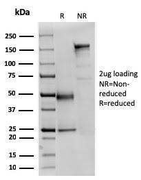 SDS-PAGE analysis of Anti-alpha Fodrin Antibody [SPTAN1/3351] under non-reduced and reduced conditions; showing intact IgG and intact heavy and light chains, respectively. SDS-PAGE analysis confirms the integrity and purity of the antibody.