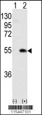 Anti-CAMK1G Rabbit Polyclonal Antibody