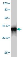 Anti-EMD Mouse Monoclonal Antibody [clone: 3B9]