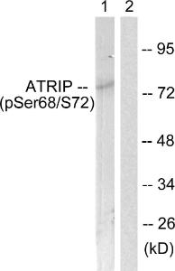 Western blot analysis of lysates from NIH/3T3 cells using Anti-ATRIP (phospho Ser68) Antibody. The right hand lane represents a negative control, where the Antibody is blocked by the immunising peptide