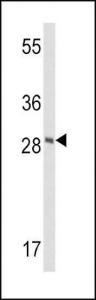 Anti-FXN Rabbit Polyclonal Antibody (Biotin)