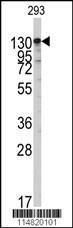 Anti-IARS2 Rabbit Polyclonal Antibody