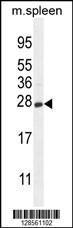 Anti-CRYGS Rabbit Polyclonal Antibody (APC (Allophycocyanin))