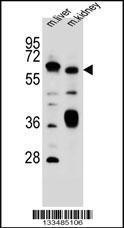 Anti-SLC2A13 Rabbit Polyclonal Antibody (AP (Alkaline Phosphatase))