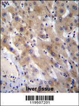 Anti-FGL1 Rabbit Polyclonal Antibody (HRP (Horseradish Peroxidase))