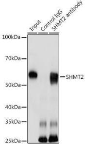 Immunoprecipitation analysis of 200µg extracts of HeLa cells using 3 µg of Anti-SHMT2/SHMT Antibody (A308252). This Western blot was performed on the immunoprecipitate using Anti-SHMT2/SHMT Antibody (A308252) at a dilution of 1:1000