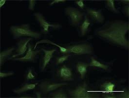 Anti-KLK2 Mouse Monoclonal Antibody [clone: 3C5]