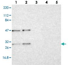 Anti-RPS4Y1 Rabbit Polyclonal Antibody