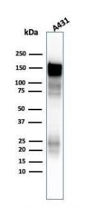 Western blot analysis of A431 cell lysate using Anti-EGFR Antibody [H9B4]