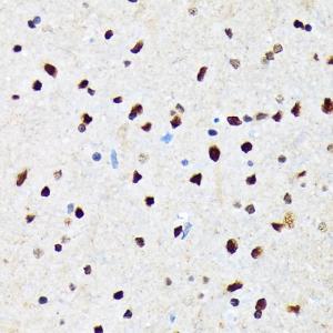 Immunohistochemistry analysis of paraffin-embedded rat brain using Anti-CAMKIV Antibody [ARC1506] (A305710) at a dilution of 1:100 (40x lens) Perform microwave antigen retrieval with 10 mM Tris/EDTA buffer pH 90 before commencing with IHC staining protocol