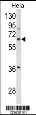 Anti-ITGBL1 Rabbit Polyclonal Antibody