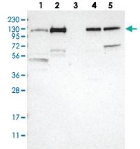 Anti-KANK2 Rabbit Polyclonal Antibody