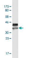 Anti-MAP3K4 Mouse Monoclonal Antibody [clone: X1]