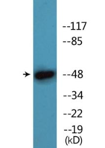 Anti-AML1