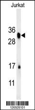 Anti-RSPO4 Rabbit Polyclonal Antibody